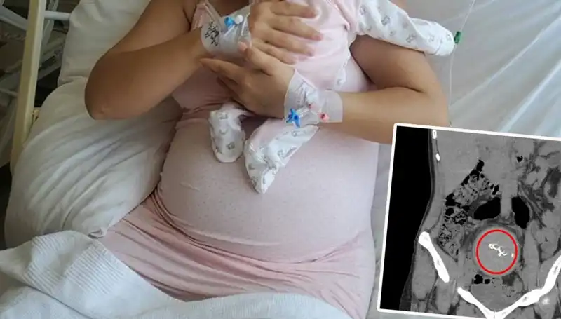 Doğumda Unutulan Bebek, İki Yıl Sonra Gazlı Bez İhmalinin Gölgesinde Ortaya Çıktı