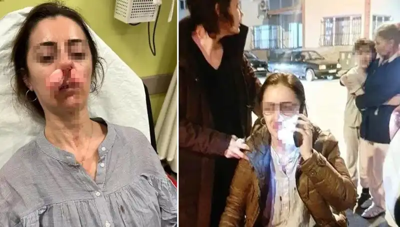 Eşinin Sevgilisi Saydığı Kişiye Otomobil Kapısıyla Saldırdı!