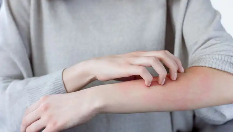Cilt Kanserinin Gizli Belirtileri: Dermatologdan Önemli Açıklamalar