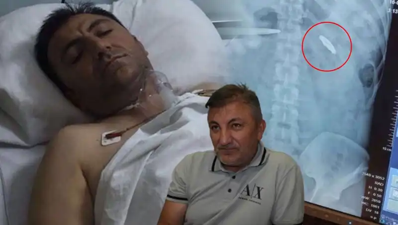 15 Temmuz'un Gölgeleri: Vücudunda Kurşun ile Taşımak Zorunda Kalanlar