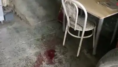 Sandalyeden Düşen Adamın Yaşadığı Kazanın Ardındaki Gerçekler