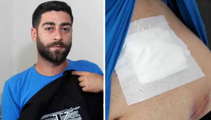 Karnındaki Ağrı Olayı, Röntgenle Şoke Edici Gerçeği Ortaya Çıkardı!