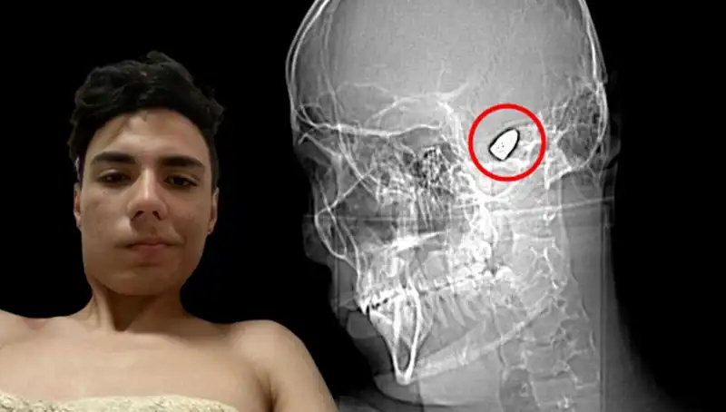 Kafasında Patlamaya Hazır Bomba Taşıyan Genç Kızın Şok Edici Hikayesi